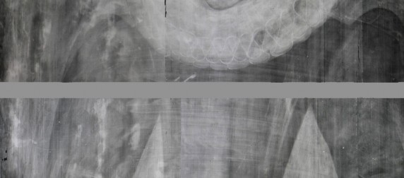Portrait of a widow x-ray